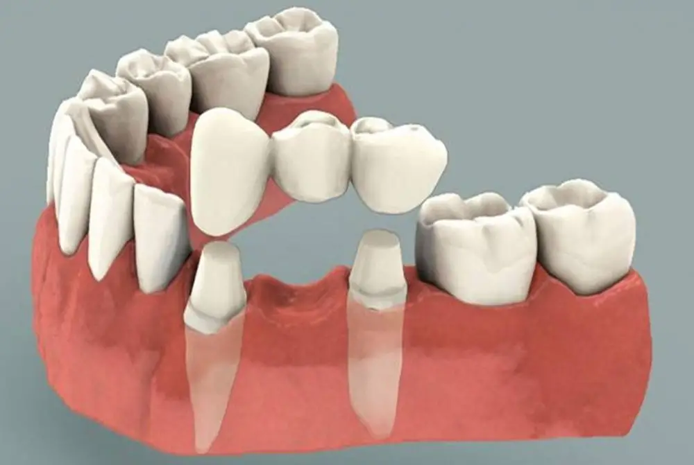 dental-image dental-image