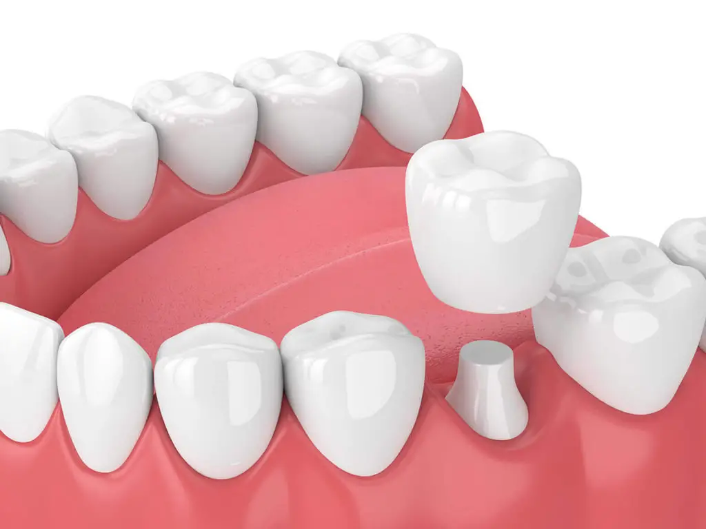 dental image dental image