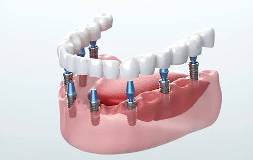 3D Dental Care 3D Dental Care