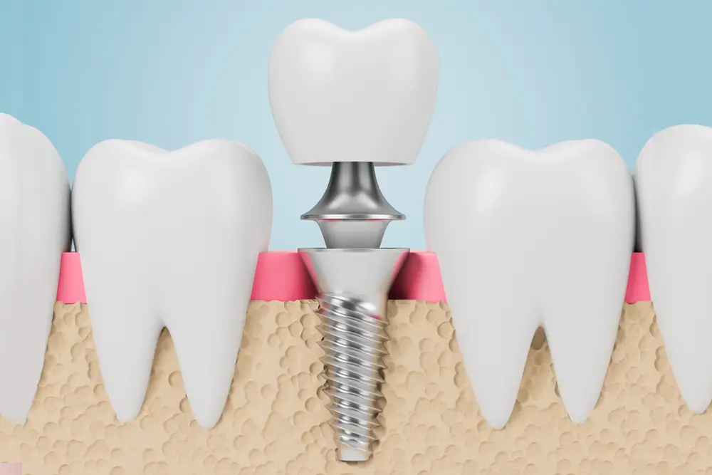 dental-image dental-image